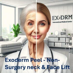 Exoderm Peel By Exoderm Medical Centers